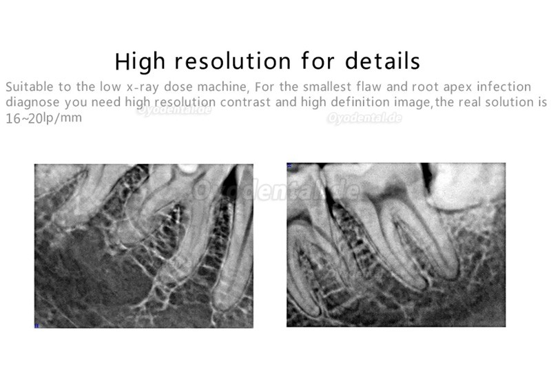 Handy HDR 500B Dental Röntgensensoren für Zahnärzte USB Digitale Handliches System